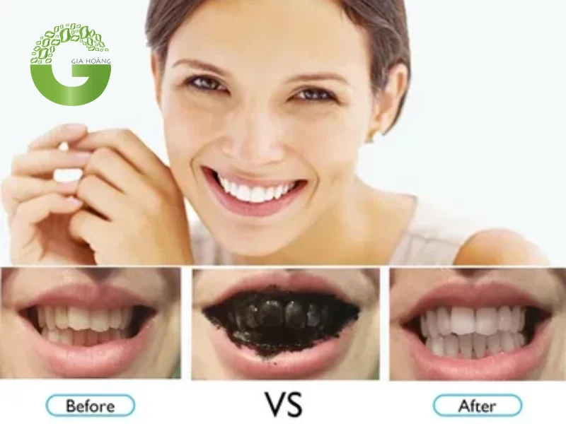 Giúp răng trở nên sáng bóng cùng than hoạt tính