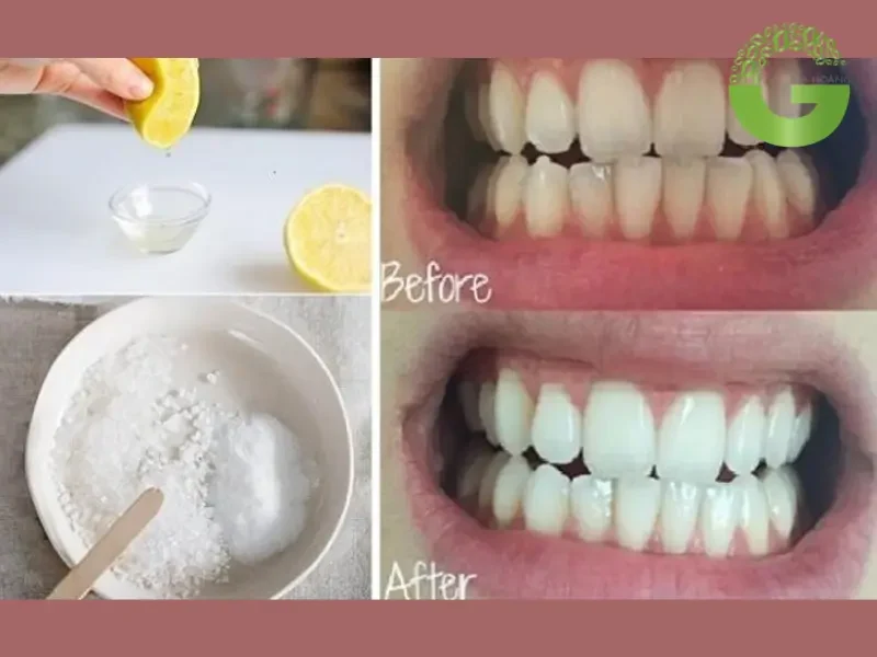 Công dụng của baking soda