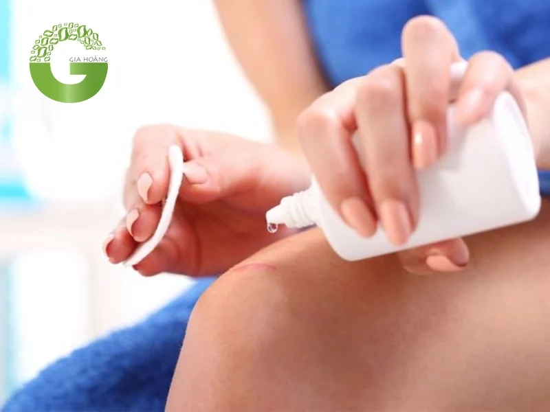 Những trường hợp không nên dùng oxy già sát khuẩn