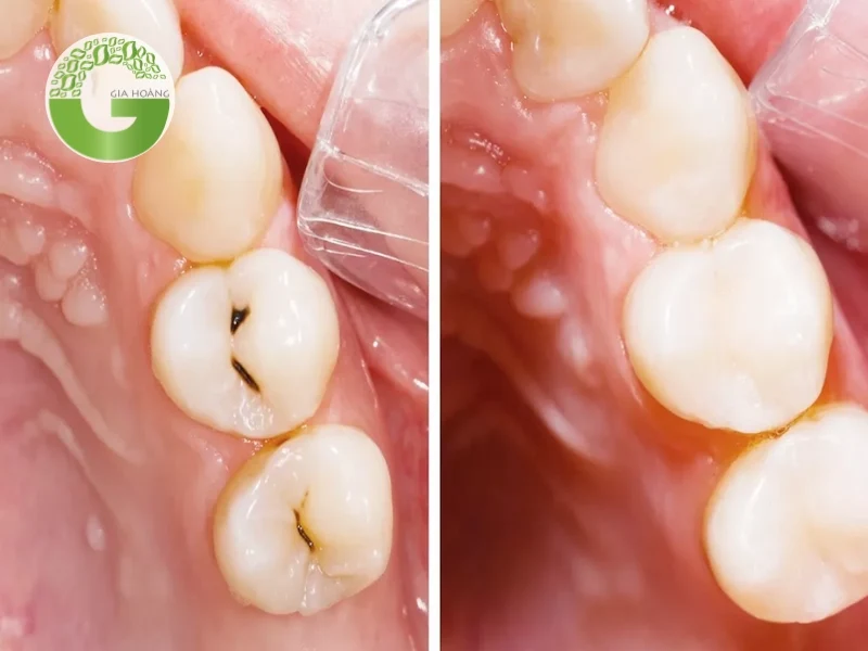 Công dụng trong y tế và nha khoa