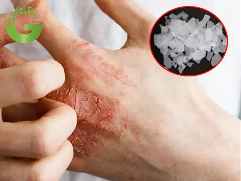 cách sử dụng xút