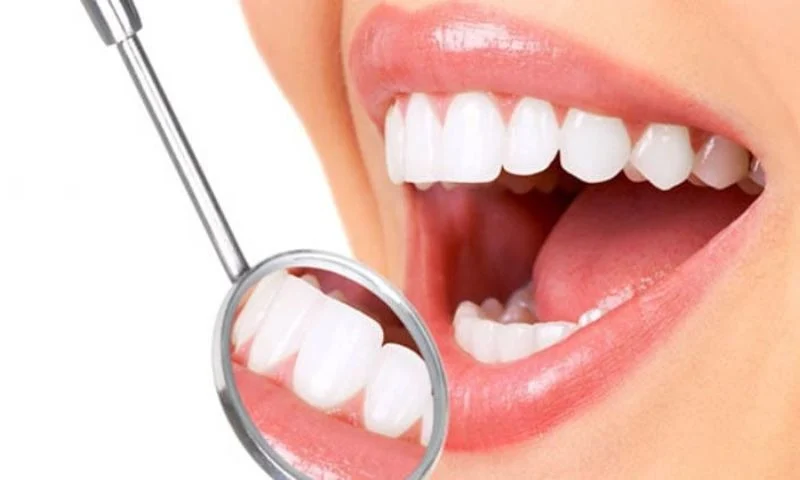 Trong nha khoa tác dụng của H2O2 là tẩy trắng răng
